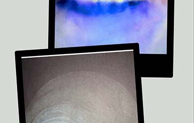 El vértigo de la totalidad: el cansancio de la mirada